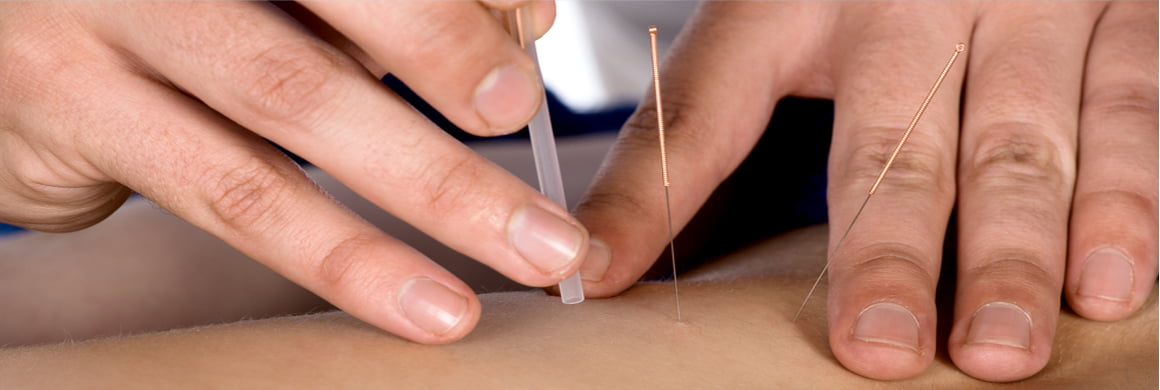 Acupuncture Be the best you can be, with Traditional Chinese Acupuncture, Chinese Herbal Medicine, Tui Na and Moxibustion
